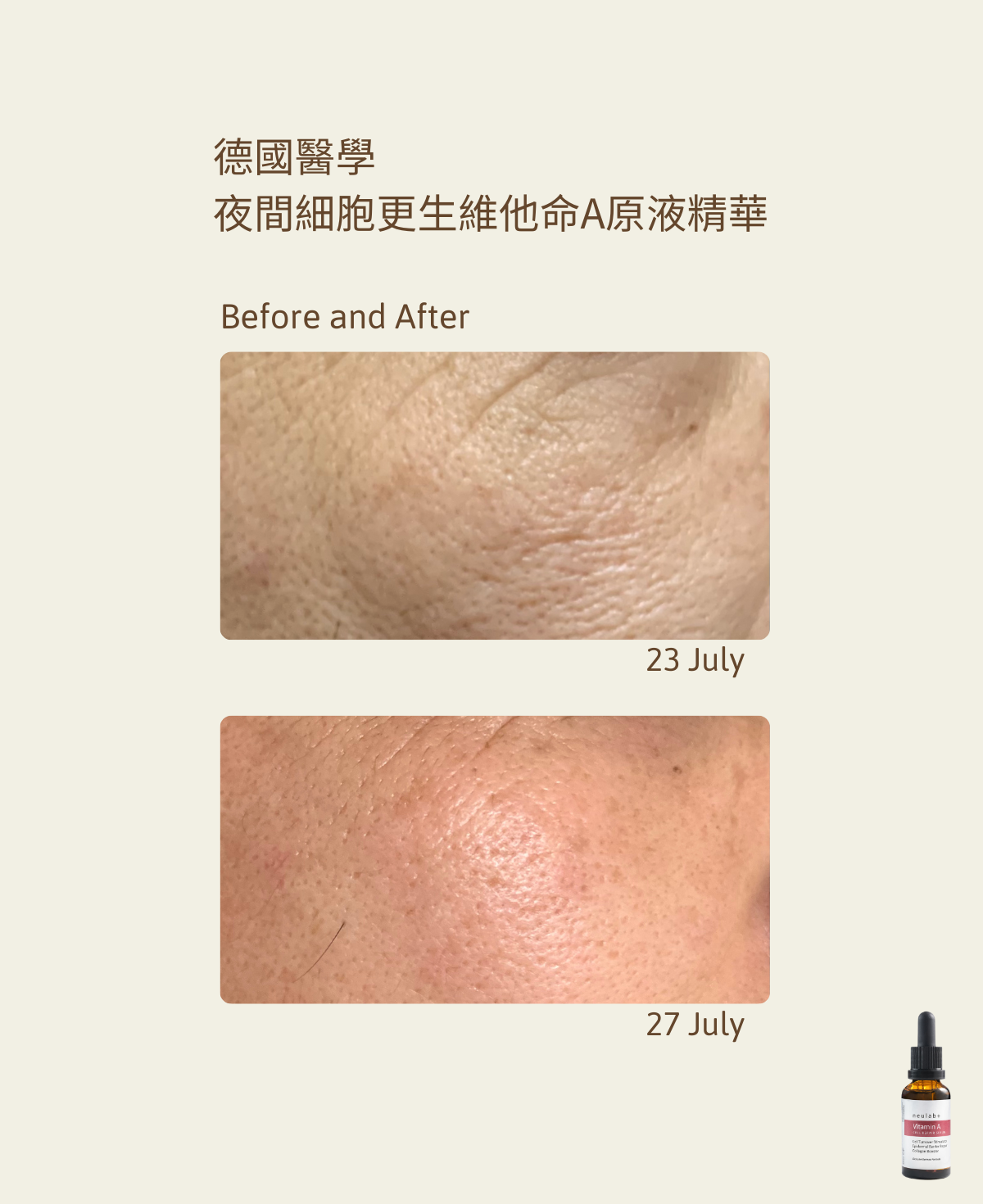 ［預計10月中旬發貨或門市自取］Vitamin A Cell Repair Serum 30ml